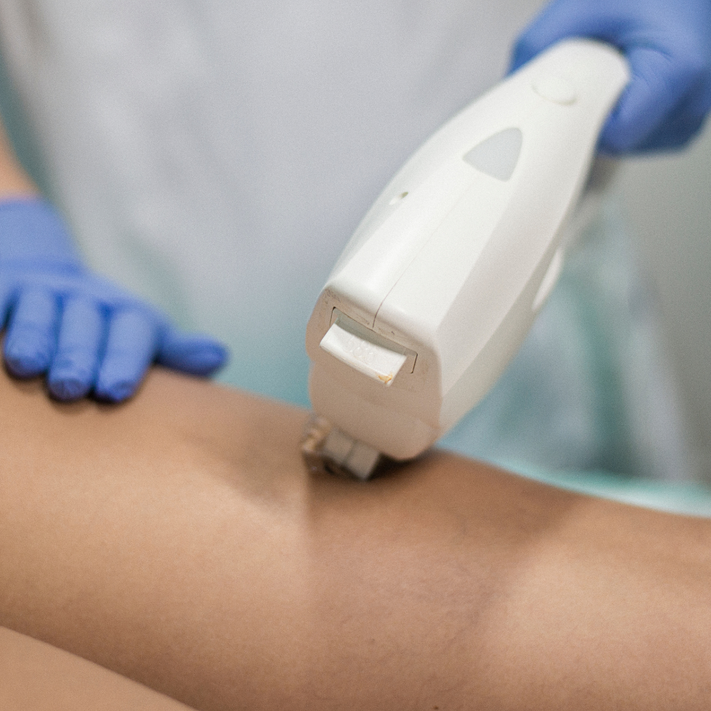 DEPILACIÓN LASER