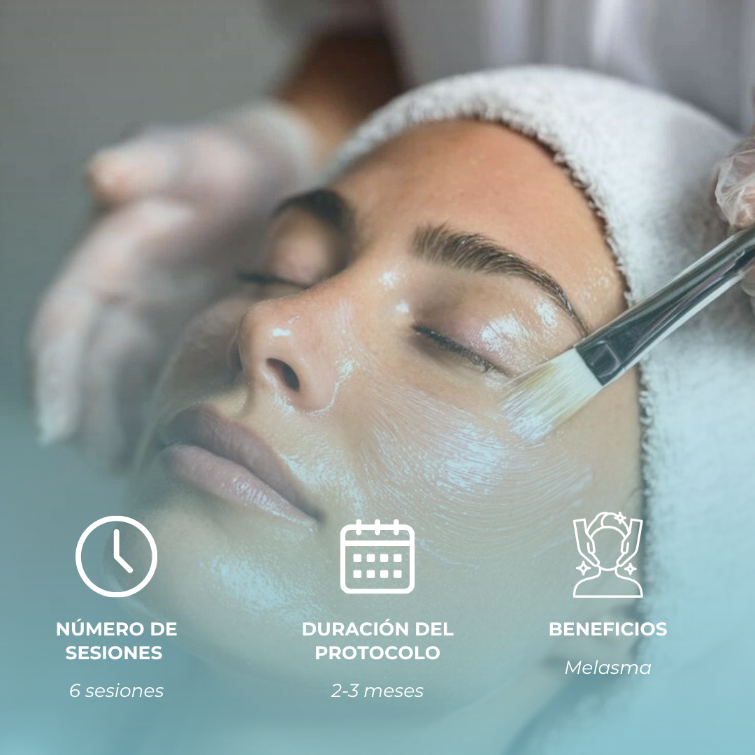 Tratamiento Melasma