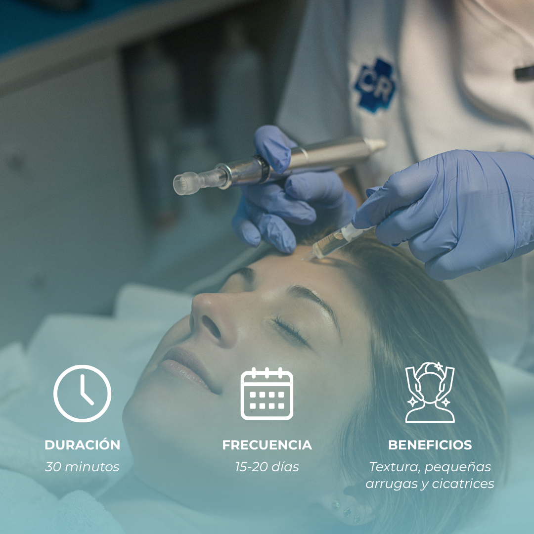Microneedling