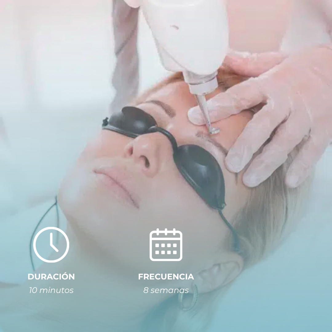 Eliminación Cejas (Micro)