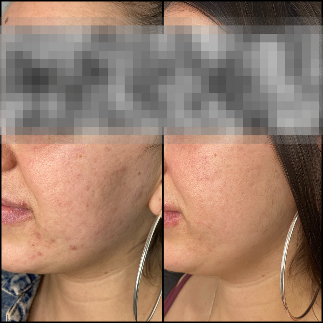 Balance Skin