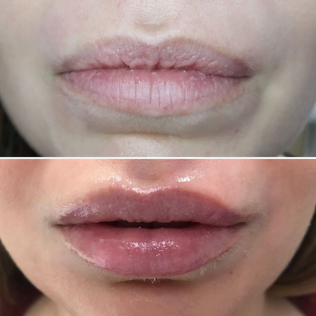 Lips Restore: Hidratación Labial