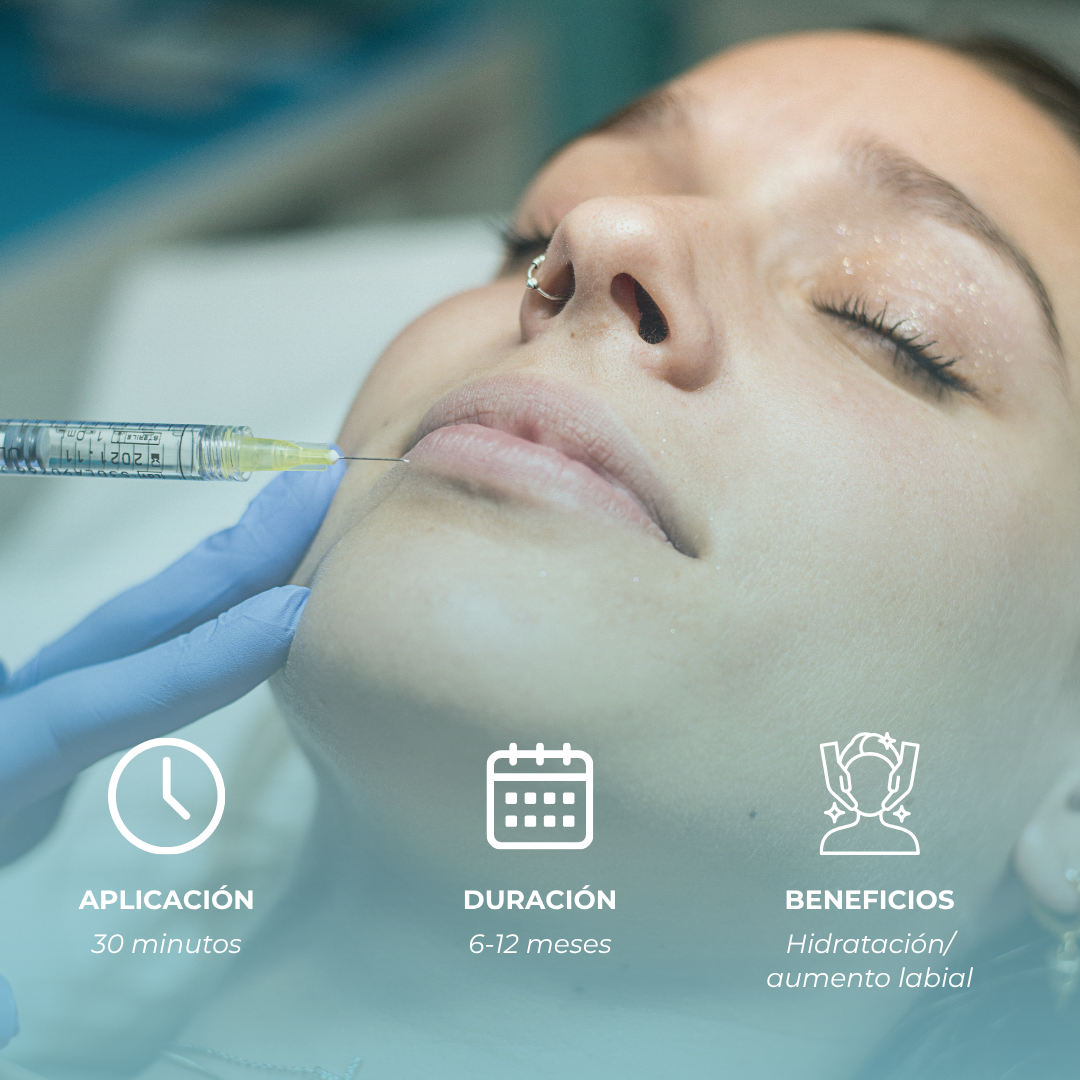 Remodelación Labial