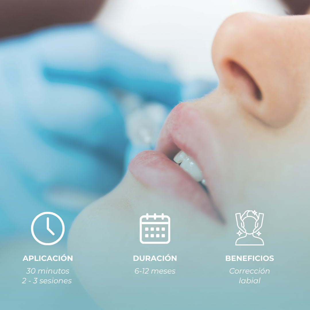 Corrección Labial