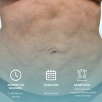 Fibrosis Post Quirúrgico