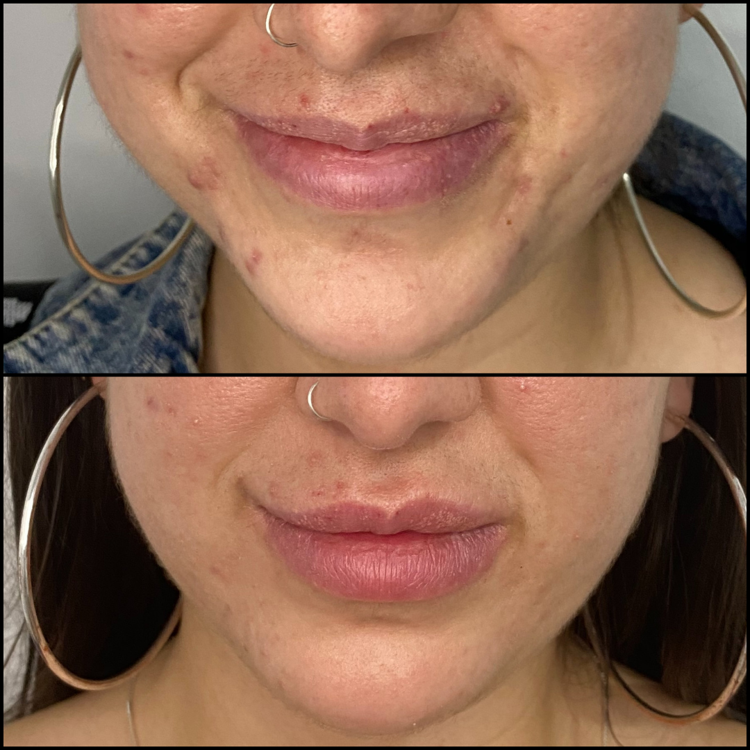 Balance Skin