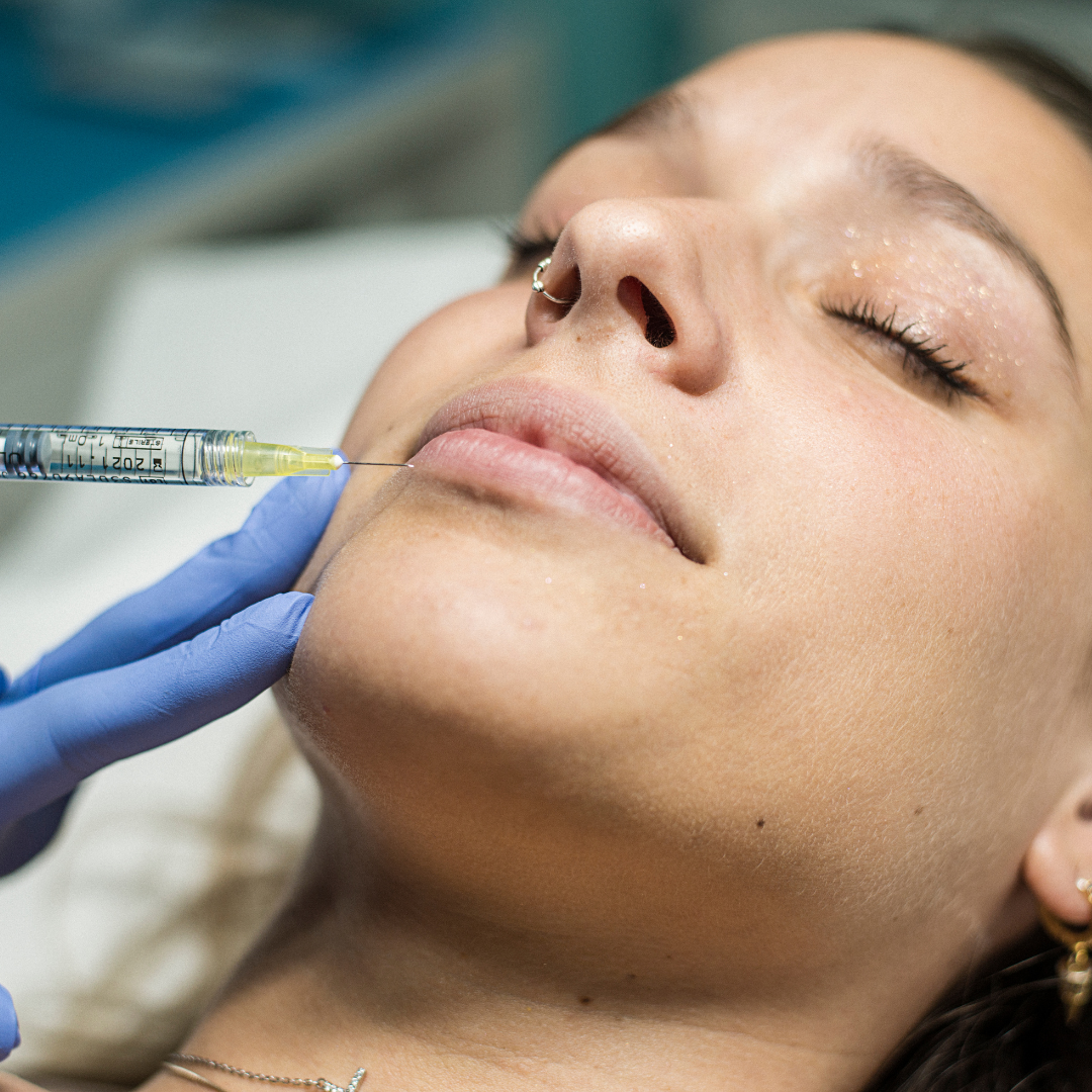 REMODELACIÓN LABIAL